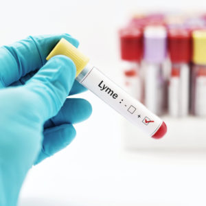 Lyme disease research